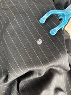 スーツ シミ抜き ビフォー